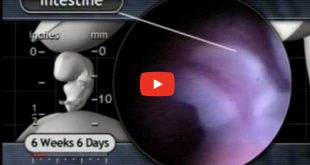 Fetal Development Video